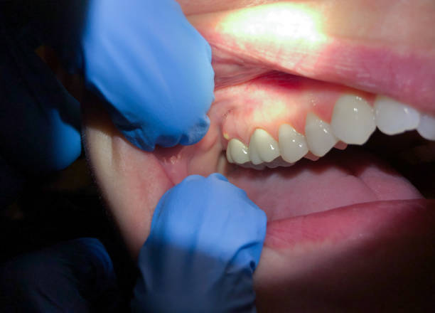 Best Emergency Dental Care for Sports Injuries in Country Club Hills, MO